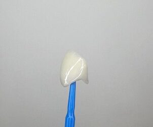 Dental Crowns Explained: Varieties, Procedures, and Aftercare