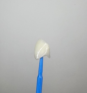 Dental Crowns Explained: Varieties, Procedures, and Aftercare