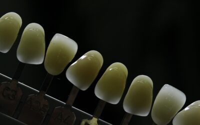 Can Dental Veneers Be Removed?
