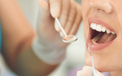 Can Dental Veneers Be Removed?