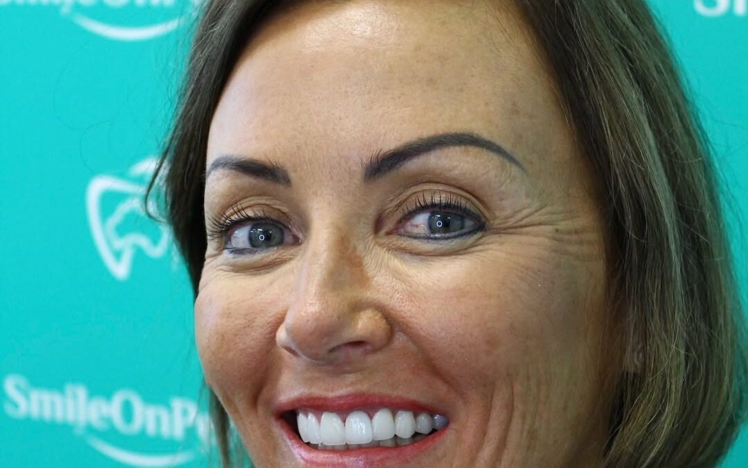 Maintaining Your Smile: Vital Dental Check-ups After Getting Veneers