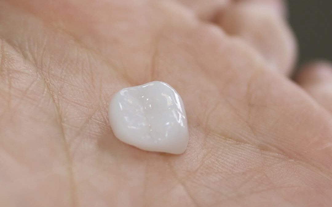 Veneers-Friendly Foods: What to Enjoy and How to Protect Your New Smile