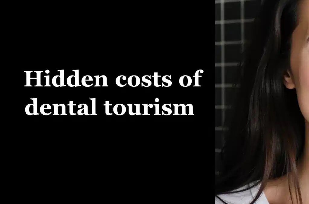 How Much Do Veneers Cost in Bali?