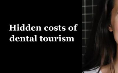 How Much Do Veneers Cost in Bali?